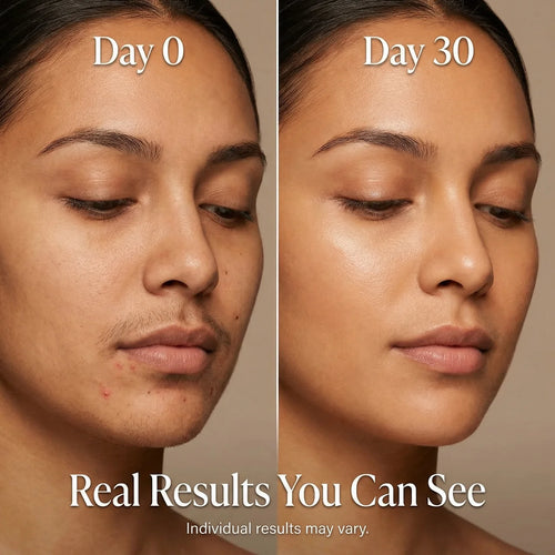 Glowen Cyperus Rotundus Oil